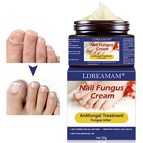 Fungo Unghie Piedi,Funghi Unghie Trattamento,anti-fungina naturale,Trattamento Unghie,per unghie danneggiate e scolorite,Migliora la salute delle unghie di mani e piedi
