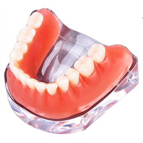 Protesi Dentale Denti Overdenture Model Inferior Precision Demo Insegnamento Denti Modello