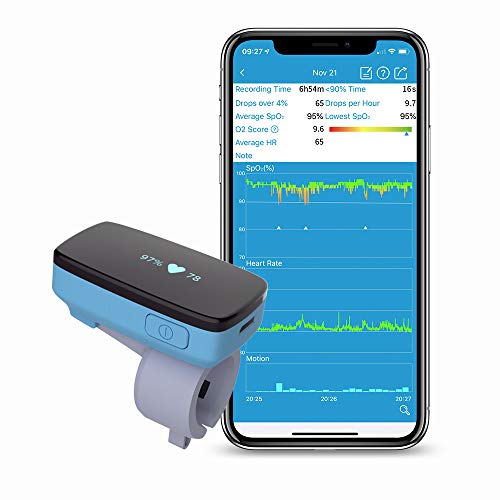 Monitor di ossigeno del sonno Viatom con allarme di vibrazione per apnea del sonno, sostituzione del saturimetro per la macchina CPAP con soluzione di russamento con bluetooth